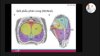 Chẩn đoán hình ảnh tiền liệt tuyến | TS. BS. Hoàng Đình Âu
