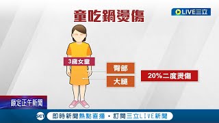 吃火鍋沒注意! 3歲女童全身20%\