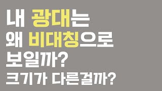 옆광대, 앞광대 왜 이렇게 틀어져보일까?