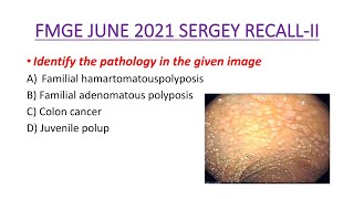 SURGERY FMGE JUNE 2021 RECALL FMGE SURGERY RECALL-II MCQ Image Based Question #Dr.clinical