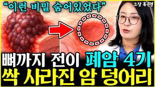 뼈까지 전이된 폐암 4기 환자, 4개월만에 기적이 일어났다 정말 깜짝 놀랐죠 l소장 류은경(1부)