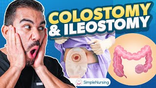 Colostomy and Ileostomy Nursing | Indications, Complications, Care EASY