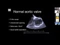 Aortic Stenosis