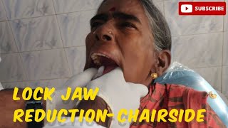 Reducing Lock Jaw- TMJ dislocation #lockjaw #dental #viralvideo #lockjawreduction #openbite #viral