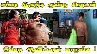 எப்படி இருந்த குண்டு சிறுவன் இப்படி ஆயிட்டான் பாருங்க || Indonesia’s fattest kid