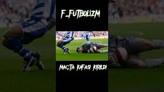 MAÇTAKİ EN KÖTÜ SAKATLIKLAR part 2 #shorts #futbol #F_futbolizm #nsakala #petercech #dembaba