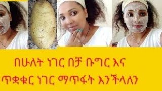 በሁለት ነገሮች በቻ ከፊታችን ለይ ቡግር እና ጠቋቁር ነገሮችን መጥፍት እንችላለን two things remove dark spots \u0026pigmentation