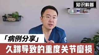 没干重活儿，膝关节软骨却几乎磨损殆尽！医生说：一个动作做太多