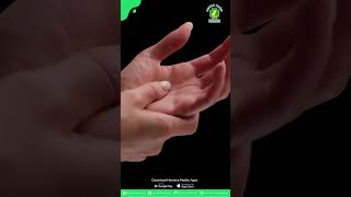 Mengenal Carpal Tunnel Syndrome (CTS), Penyakit yang Sering Dialami Wanita