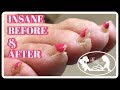 Pedicure Tutorial: Elderly Thick Toenails Growing Up Transformation Pedicure Tutorial: Elderly Thick Toenails Growing Up Transformation