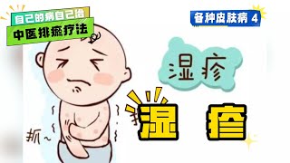 自己的病自己治 - 【中医排瘀疗法】各种常见疾病4 『湿疹』