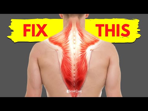 What causes upper back tightness?