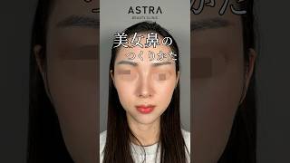 美女鼻のつくりかた🩵#アストラビューティクリニック #astrabeautyclinic #忘れ鼻 #美容整形 #鼻整形