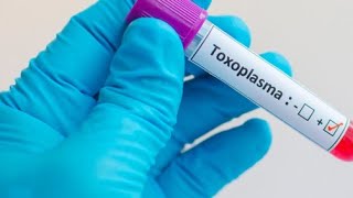 Toxoplasmosis- Fisiopatología-Diagnostico-tratamiento-profilaxis