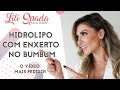 HIDROLIPO COM ENXERTO NOS GLÚTEOS! COMO É? | LILI SPADA