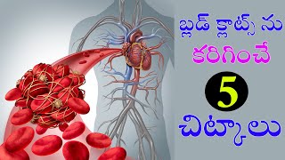 బ్ల‌డ్ క్లాట్స్ ను క‌రిగించే 5 చిట్కాలు | Tips On Blood Cott | Blood Cott Tips