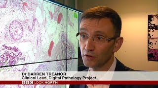 First fully digital pathology laboratory for routine cancer diagnosis in Leeds