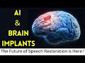 AI Powered Brain Implant : The New Hope for #speech  Restoration