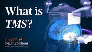 What is TMS? How TMS Works to Treat Depression