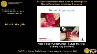 Anastomotic construction: Suture material - Is there any science?