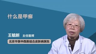 什么是甲癣 王毓新 北京华医中西医结合皮肤病医院