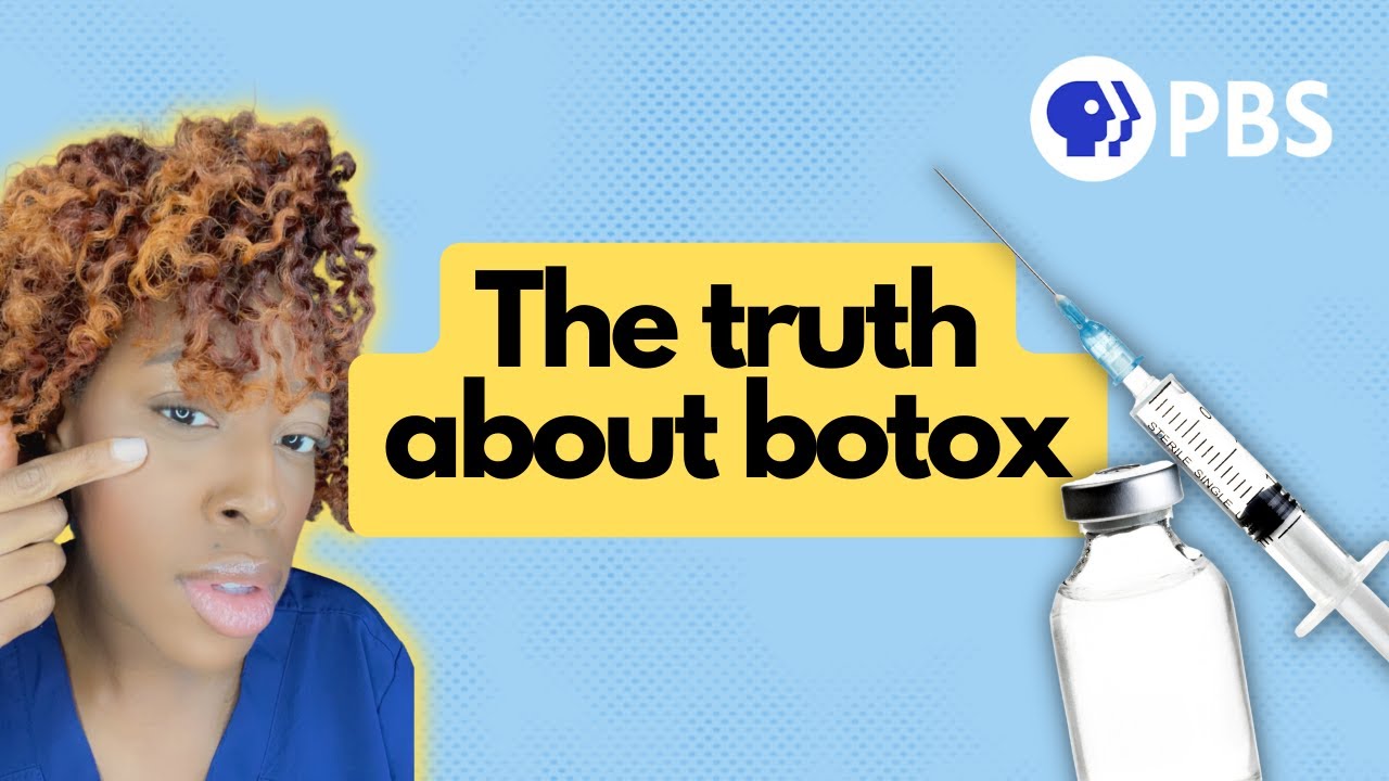 What Is "Baby Botox" And Why Are Younger People Doing It? - YouTube