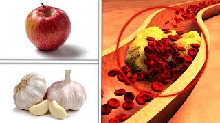 Foods that lower cholesterol fast - Eat These 4 Foods Every Day To Lower Your Cholesterol