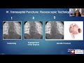 transseptal puncture from basics to advanced dr. anita asgar