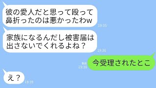 兄の結婚式の前日、家に遊びに来た妹の私を殴って鼻を折った兄の婚約者は「泥棒猫と勘違いした」と言った→被害届を出さないように脅迫する彼女に真実を伝えた結果www