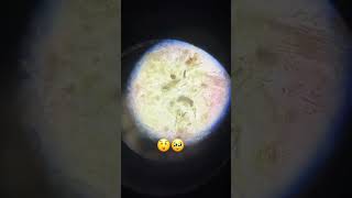 The Micros are everywhere and we love to see it #biology #microorganisms #sciencebae