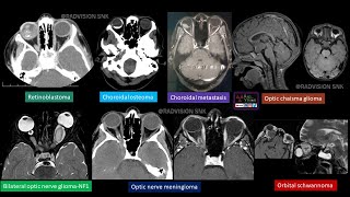 IMAGING IN ORBITAL PATHOLOGIES