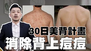 背上痘痘徹底消除 !! 30天最強美背計畫，夏天來臨前必學~~【77老大】