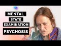Psychosis (Schizophrenia) | Mental State Examination (MSE) | OSCE Guide |  SCA Case | UKMLA | CPSA