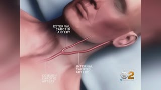 Dr. Max Gomez: Dangerous Hickeys