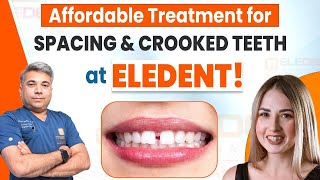 Get the Perfect Smile: Affordable Treatment for Crooked and Spacing Teeth at Eledent |Eledent Dental