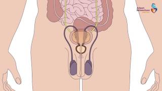 PROSTAATVERWIJDERING   Robot geassisteerde laparoscopische prostatectomie RALP