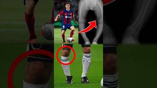 Por quê os jogadores de futebol tem as pernas tortas?