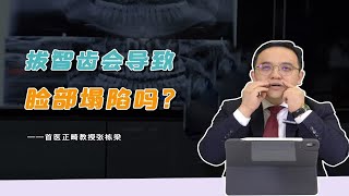 拔牙会变老？拔智齿还会导致脸部凹陷下垂？