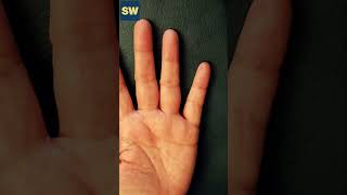 For Bloating and Gas relief Abdominal Distention - Hand Acupuncture  Self Acupressure