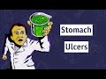 Can You Catch Stomach Ulcers?