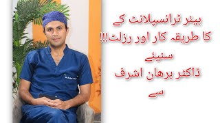 Hair Transplant Details Procedure and Results Explained by Dr Burhan Ashraf