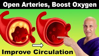 Blocked Arteries? These 5 Foods Help Restore Blood Flow FAST!  Dr. Mandell