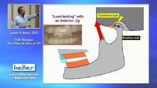 15 Load Testing errors
