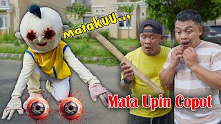 BOLA MATA UPIN COPOT TERKENA TONGKAT BASEBALL