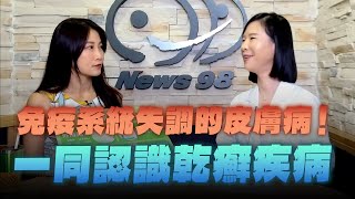 '24.08.26【名醫On Call】黃毓惠醫師談「免疫系統失調的皮膚病！一同認識乾癬疾病」