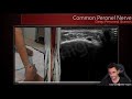 lower limb nerves anatomy u0026 us part ii common peroneal nerve