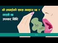 तपाईको सास गन्हाउ छ यस्तो छ उपचार विधि easy ways to finally get rid of bad breath halitosis