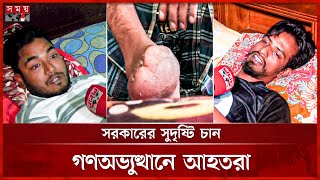 কেউ হারিয়েছেন পা; কারও শরীর বুলেটবিদ্ধ, ভবিষ্যত অনিশ্চিত | Student Movement | July Revolution