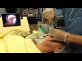 Airtraq Guided Video Intubation - A360+iPad Gentle Intubation