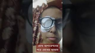 চোখ অপারেশনের পরে চোখের ব্যায়াম করা দেখুন See eye exercises after eye surgery